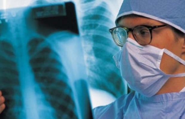 Pse tuberkulozi, sëmundja më infektive në botë, po rritet në Mbretërinë e Bashkuar?